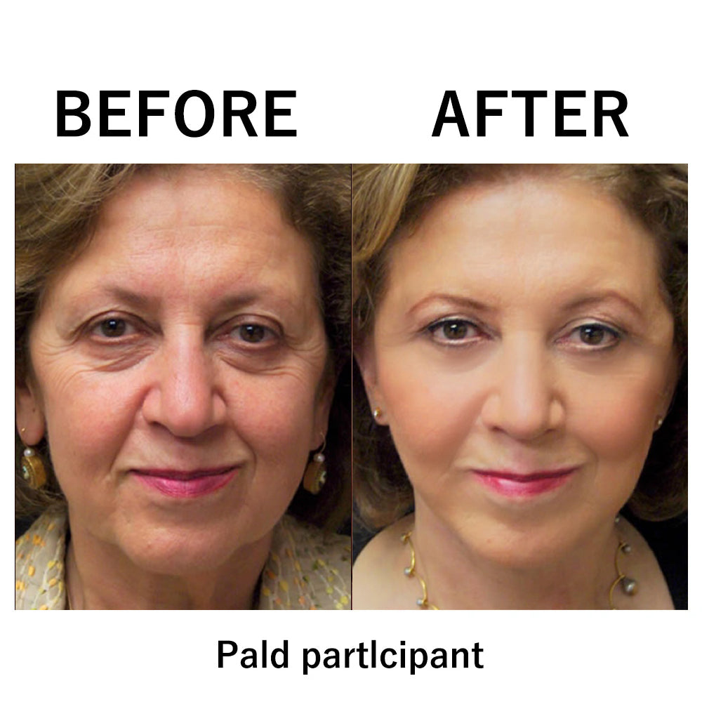 🔥 Dernière remise : 87 % de réduction sur 🌸 Raffermissant instantané pour le visage