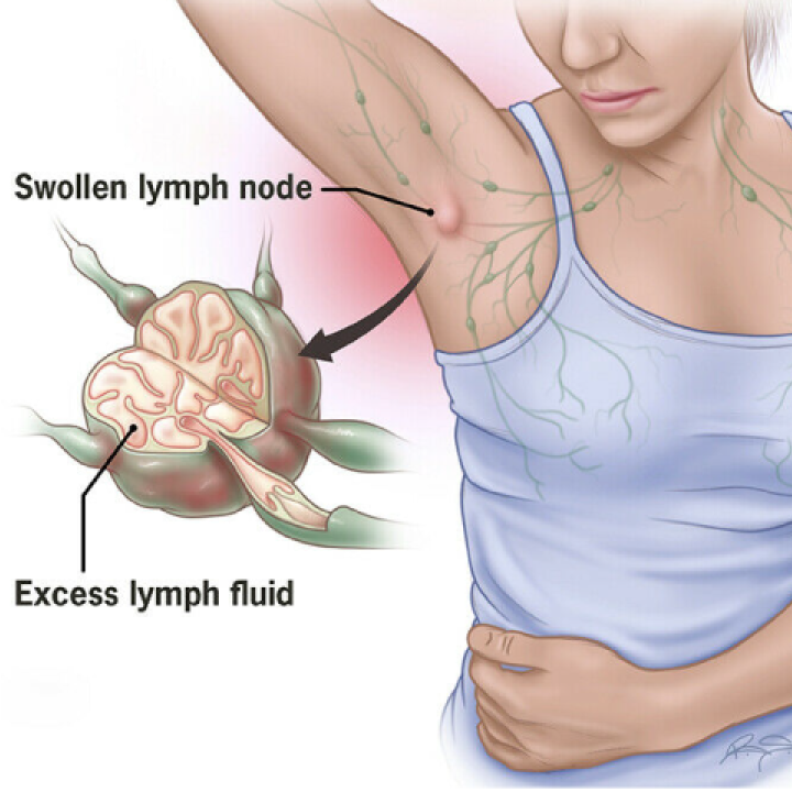 Huile de Gingembre pour Drainage Lymphatique - Promotion Dernier Jour