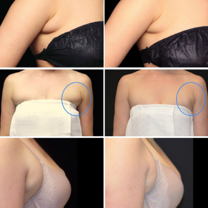 Huile de Gingembre pour Drainage Lymphatique - Promotion Dernier Jour
