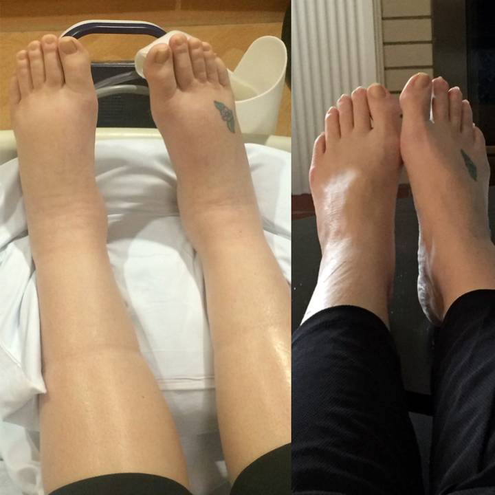 Huile de Gingembre pour Drainage Lymphatique - Promotion Dernier Jour