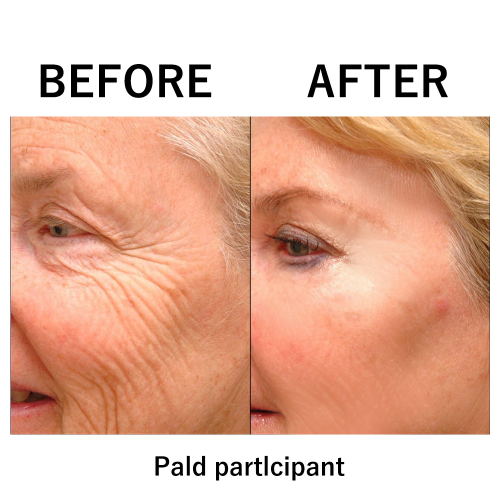 🔥 Dernière remise : 87 % de réduction sur 🌸 Raffermissant instantané pour le visage