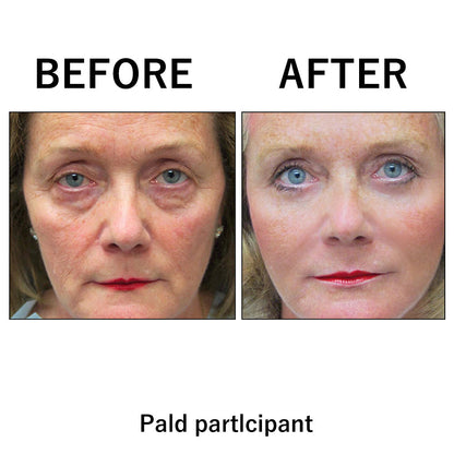 🔥 Dernière remise : 87 % de réduction sur 🌸 Raffermissant instantané pour le visage