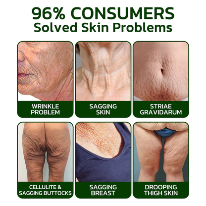 HZA™ Avocado Tightening & Wrinkles Reducing Body Lotion Scrub (CDA Recommended)
